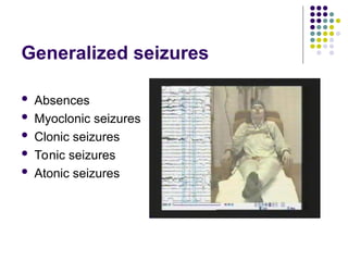 Generalized seizures
 Absences
 Myoclonic seizures
 Clonic seizures
 Tonic seizures
 Atonic seizures
 