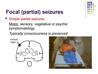 Focal (partial) seizures
 Simple partial seizures
Motor, sensory, vegetative or psychic
symptomatology
Typically consciousness is preserved
 