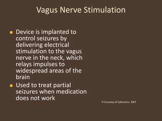 Potentially Dangerous Responses to SeizureDO NOTPut anything in the person’s mouthTry to hold down or restrain the personAttempt to give oral anti-seizure medicationKeep the person on their back face up throughout convulsion