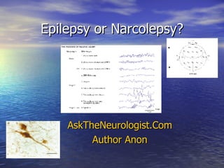 Epilepsy or Narcolepsy? AskTheNeurologist.Com Author Anon 