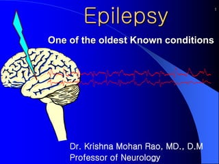 Epilepsy
One of the oldest Known conditions
Dr. Krishna Mohan Rao, MD., D.M
Professor of Neurology
1
 