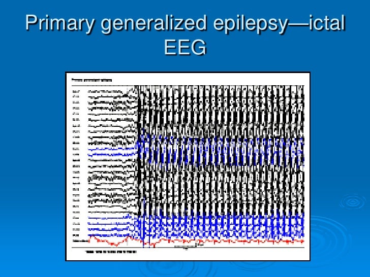 eeg epilepsy vs normal