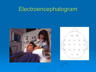 Electroencephalogram
