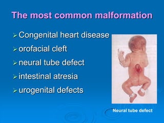 Features common to the surgically privileged seizure disordersPresence of a well-circumscribed structural lesion on the MRI (lesional epilepsy)Presence of well-localized interictal epileptiform discharged on the EEGClinical features of habitual seizures indicating focal onsetAbsence of discordance between above featureFocus localized by above features is surgically accessible and involves little or no eloquent cortexAbsence of other potentially epileptogenic abnormalities