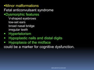 Minor malformations
Fetal anticonvulsant syndrome
Dysmorphic features
V-shaped eyebrows
low-set ears
broad nasal bridge
irregular teeth
 Hypertelorism
 Hypoplastic nails and distal digits
 Hypoplasia of the midface
could be a marker for cognitive dysfunction.
ABOUBAKR ELNASHAR
 