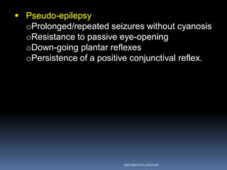  Pseudo-epilepsy
oProlonged/repeated seizures without cyanosis
oResistance to passive eye-opening
oDown-going plantar reflexes
oPersistence of a positive conjunctival reflex.
ABOUBAKR ELNASHAR
 