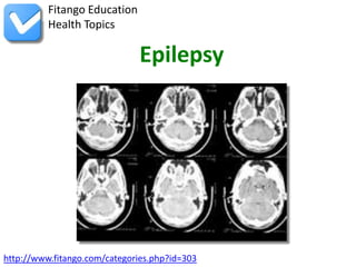 Fitango Education
          Health Topics

                              Epilepsy




http://www.fitango.com/categories.php?id=303
 