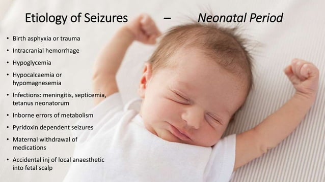 Seizure Disorders in Children | PPTX | Brain and Nervous System ...