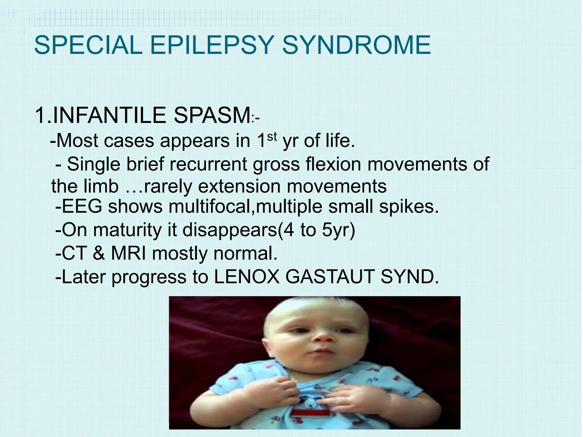 pediatrics. epilepsy and seizures in children 8.ppt | Brain and Nervous ...