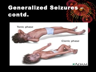 Generalized Seizures –
contd.
 