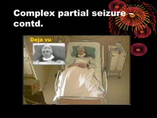 Complex partial seizure –
contd.
Deja vu
 