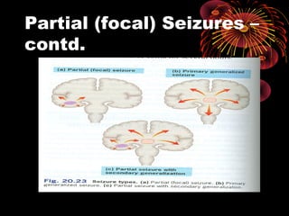 Partial (focal) Seizures –
contd.
 