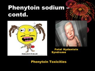 Phenytoin sodium –
contd.
Phenytoin Toxicities
Fetal Hydantoin
Syndrome
 