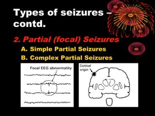 Types of seizures –
contd.
2. Partial (focal) Seizures
A. Simple Partial Seizures
B. Complex Partial Seizures
 