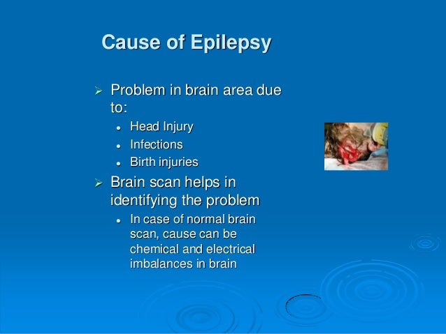 Epilepsy General information in English