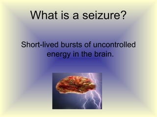 What is a seizure?

Short-lived bursts of uncontrolled
        energy in the brain.
 