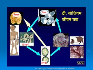 General Information About Epilepsy in Hindi | PDF