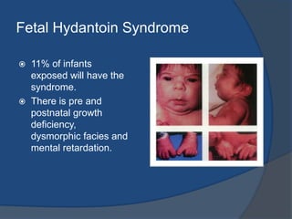 Effects of Epilepsy on NeonateThere is increased risk for infants of epileptic mothers to have epilepsy. The risk of neonatal susceptibility depends on:Nature of the mother’s seizure disorder.Genetic factors.Seizures arises during pregnancy.Metabolic & toxic consequences of seizures and AEDs.Increase perinatal morbidity.