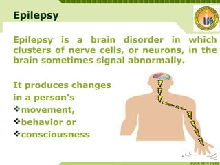 Epilepsy & its management | PPT