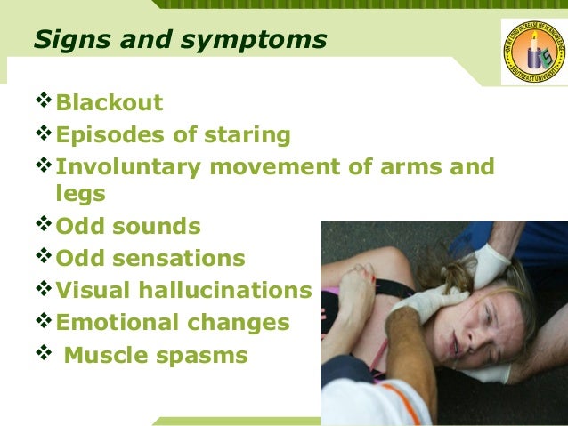 signs of a seizure in a epilepsy its management signs of a seizure in a epilepsy its management