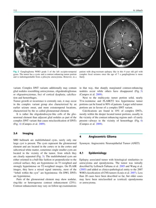 variant. Complex DNT variants additionally may contain
glial nodules resembling astrocytomas, oligodendrogliomas
or oligoastrocytomas, foci of cortical dysplasia, calciﬁca-
tion and hemorrhages.
Tumor growth or recurrence is extremly rare, it may occur
in the complex variant group also characterized by an
earlier seizure onset, and more extratemporal locations,
characterized by the so called glioneuronal element.
It is rather the oligodendrocyte-like cells of the glio-
neuronal element than adjacent glial nodules as part of the
complex DNT variant that cause misclassiﬁcation of DNTs
(Fig. 4) (Campos et al. 2009).
3.4 Imaging
MRI hallmark are multilobulated cysts, rarely only one
large cyst is present. The cysts represent the glioneuronal
element and are located in the cortex or in the cortex and
subcortical white matter, sometimes single smaller cysts are
located in the vicinity of the tumor, from which they
are clearly separated (Fig. 3). The multilobulated cysts are
either oriented in a ball-like fashion or perpendicular to the
cortical surface; they are hypointense on T1-weighted and
strongly hyperintense on T2-weighted images. On FLAIR
images, they have a mixed signal intensity, most of the
‘‘lobuli within the cyst’’ are hypointense. On DWI, DNTs
are hypointense.
Parts of the glioneuronal element may show nodular,
ring-like or heterogenous contrast enhancement (25%).
Contrast enhancement may vary on follow-up examinations
in that way, that sharply marginated contrast-enhancing
nodules occur while others have disappeared (Fig. 3)
(Campos et al. 2009).
Next to the multicystic tumor portion solid, nearly
T1w-isointense and FLAIR/T2 less hyperintense tumor
portions can be found in 90% of patients. Larger solid tumor
portions are in favour of a complex DNT variant.
Calciﬁcations are found in 10% of complex DNTs,
mostly within the deeper located tumor portions, usually in
the vicinity of the contrast enhancing regions and—if rarely
present—always in the vicinity of hemorrhage (Fig. 4)
(Campos et al. 2009).
4 Angiocentric Glioma
Synonym: Angiocentric Neuroepithelial Tumor (ANET)
4.1 Epidemiology
Epilepsy associated tumor with histological similarities to
astrocytoma and ependymoma. The tumor was initially
described by Lellouch-Tubiana et al. 2005 and Wang et al.
(2005) and added as clinico-pathological entity to the 2007
WHO classiﬁcation of CNS tumors (Louis et al. 2007). Less
than 20 cases have been described so far, but older cases
may have been misclassiﬁed as (cortical) ependymoma
or astrocytoma.
Fig. 2 Ganglioglioma WHO grade I of the left occipito-temporal
gyrus. The tumor has a cystic and a contrast enhancing tumor portion
and is indistinguishable from a pilocytic atsrocytoma. However, in a
patient with drug-resistant epilepsy like in this 9 year old girl with
complex focal seizures since the age of 7 a ganglioglioma is more
likely
112 H. Urbach
 