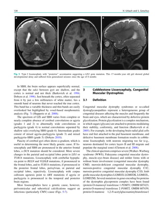 In SBH, the brain surface appears superﬁcially normal,
except that the sulci between gyri are shallow, and the
cortex is normal and not thick (Barkovich et al. 1994;
Dobyns et al. 1996). Just beneath the cortex, often separated
from it by just a few millimeters of white matter, lies a
smooth band of neurons that never reached the true cortex.
This band has a variable thickness and thin bands are easily
overlooked but highlighted by voxel-based morphometric
analysis (Fig. 7) (Huppertz et al. 2008).
The spectrum of LIS and SBH varies from complete or
nearly complete absence of cerebral convolutions or agyria
(grades 1 and 2) to abnormally wide convolutions or
pachygyria (grade 4) to normal convolutions separated by
shallow sulci overlying SBH (grade 6). Intermediate grades
consist of mixed agyria–pachygyria (grade 3) and mixed
pachygyria–SBH (grade 5) (Dobyns 2010).
Paucity of cerebral gyri often shows a gradient, which is
useful in determining the most likely genetic cause. If lis-
sencephaly and SBH are pronounced in the anterior frontal
lobes, a DCX mutation should be considered. More severe
changes in the parietal and occipital lobes point to LIS1 or
TUB1A mutations. Lissencephaly with cerebellar hypopla-
sia point to RELN and VLDLR mutations, if pronounced in
the frontal lobes, and to TUB1A mutations, if pronounced in
the posterior frontal lobes, perisylvian, or parietal and
occipital lobes, repectively. Lissencephaly with corpus
callosum agenesis point to ARX mutations if agyria or
pachygyria is pronounced in the temporal and posterior
brain regions.
Most lissencephalies have a genetic cause, however,
periventricular and subcortical calciﬁcations suggest an
infectious (particularly CMV) cause (Figs. 5-7).
3 Cobblestone Lissencephaly, Congenital
Muscular Dystrophies
3.1 Definition
Congenital muscular dystrophy syndromes or so-called
dystroglycanopathies represent a heterogeneous group of
congenital diseases affecting the muscles and frequently the
brain and eyes, which are characterized by defective protein
glycolization. Protein glycolization is a complex mechanism,
in which sugars (glycans) are attached to proteins modulating
their stability, conformity, and function (Barkovich et al.
2005). For example, in the developing brain radial glial cells
have end feet attached to the pial basement membrane, and
defective basement membrane formation results in cobble-
stone lissencephaly with neurons migrating too far (e.g.,
neurons destinated for cortex layers II and III migrate and
populate the marginal zone) (Clement et al. 2008).
The clinical spectrum comprises severe [Walker–Warburg
syndrome (WWS), Fukuyama congenital muscular dystro-
phy, muscle–eye–brain disease] and milder forms with or
without brain involvement (congenital muscular dystrophy
CMD, merosin-deﬁcient congenital muscular dystrophy,
merosin-positive congenital muscular dystrophy C1C,
merosin-positive congenital muscular dystrophy C1D, limb
girdle muscular dystrophies LGMD2I, LGMD2K, LGMD2L,
LGMD2M). Several mutations in genes encoding for proteins
of the dystrophin glycoprotein complex have been found
(protein-O-mannosyl transferase 1 POMT1, OMIM 607423;
protein-O-mannosyl transferase 2 POMT2, OMIM 607439;
protein-O-mannose 1,2-N-acetylglucosaminyltransferase1
Fig. 5 Type I lissencephaly with ‘‘posterior’’ accentuation suggesting a LIS1 gene mutation. This 17 months year old girl showed global
developmental delay and suffered from generalized seizures since the age of 8 months
134 H. Urbach and S. Greschus
 