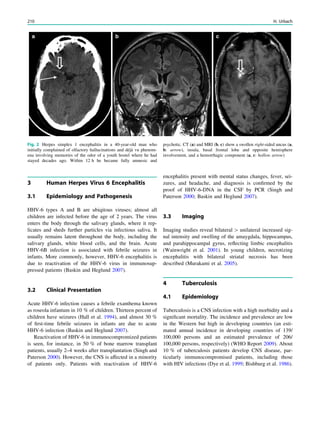 3 Human Herpes Virus 6 Encephalitis
3.1 Epidemiology and Pathogenesis
HHV-6 types A and B are ubiqitous viruses; almost all
children are infected before the age of 2 years. The virus
enters the body through the salivary glands, where it rep-
licates and sheds further particles via infectious saliva. It
usually remains latent throughout the body, including the
salivary glands, white blood cells, and the brain. Acute
HHV-6B infection is associated with febrile seizures in
infants. More commonly, however, HHV-6 encephalitis is
due to reactivation of the HHV-6 virus in immunosup-
pressed patients (Baskin and Heglund 2007).
3.2 Clinical Presentation
Acute HHV-6 infection causes a febrile exanthema known
as roseola infantum in 10 % of children. Thirteen percent of
children have seizures (Hall et al. 1994), and almost 30 %
of ﬁrst-time febrile seizures in infants are due to acute
HHV-6 infection (Baskin and Heglund 2007).
Reactivation of HHV-6 in immunocompromized patients
is seen, for instance, in 50 % of bone marrow transplant
patients, usually 2–4 weeks after transplantation (Singh and
Paterson 2000). However, the CNS is affected in a minority
of patients only. Patients with reactivation of HHV-6
encephalitis present with mental status changes, fever, sei-
zures, and headache, and diagnosis is conﬁrmed by the
proof of HHV-6-DNA in the CSF by PCR (Singh and
Paterson 2000; Baskin and Heglund 2007).
3.3 Imaging
Imaging studies reveal bilateral [ unilateral increased sig-
nal intensity and swelling of the amaygdala, hippocampus,
and parahippocampal gyrus, reﬂecting limbic encephalitis
(Wainwright et al. 2001). In young children, necrotizing
encephalitis with bilateral striatal necrosis has been
described (Murakami et al. 2005).
4 Tuberculosis
4.1 Epidemiology
Tuberculosis is a CNS infection with a high morbidity and a
signiﬁcant mortality. The incidence and prevalence are low
in the Western but high in developing countries (an esti-
mated annual incidence in developing countries of 139/
100,000 persons and an estimated prevalence of 206/
100,000 persons, respectively) (WHO Report 2009). About
10 % of tuberculosis patients develop CNS disease, par-
ticularly immunocompromised patients, including those
with HIV infections (Dye et al. 1999; Bishburg et al. 1986).
Fig. 2 Herpes simplex 1 encephalitis in a 40-year-old man who
initially complained of olfactory hallucinations and déjà vu phenom-
ena involving memories of the odor of a youth hostel where he had
stayed decades ago. Within 12 h he became fully amnesic and
psychotic. CT (a) and MRI (b, c) show a swollen right-sided uncus (a,
b: arrow), insula, basal frontal lobe and opposite hemisphere
involvement, and a hemorrhagic component (a, c: hollow arrow)
210 H. Urbach
 