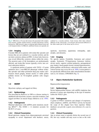 1.3.4 Imaging
Consider MELAS in patients with stroke-like episodes and
lesions that are not conﬁned to a vascular territory and do
not show cytotoxic edema on DWI. A closer look, however,
may reveal ribbon-like cytotoxic edema within the cortex.
The posterior parts of the hemispheres are predominantly
affected, and stroke-like lesions typically evolve into cor-
tical–subcortical defects.
A signiﬁcant portion of patients with 3243A [ G point
mutations have a non-MELAS phenotype without stroke-
like episodes and either prominent deep gray matter calci-
ﬁcations (basal ganglia, dentate nuclei) or subtle globus
pallidus lesions on T2-weighted gradient echo images
(Fig. 3).
1.4 MERRF
Myoclonic epilepsy and ragged red ﬁbers.
1.4.1 Epidemiology
First described by Berkovic in 1989 as a disease starting in
adulthood with myoclonic seizures, muscular weakness, and
ragged red ﬁbers on muscle biopsy (Berkovic et al. 1989).
1.4.2 Pathogenesis
Maternal inheritance with mtDNA point mutations encod-
ing tRNALys
. The 8344G [ A mutation accounts for
80–90 % of cases.
1.4.3 Clinical Presentation
Broad spectrum, ranging from oligosymptomatic proximal
myopathy to severe impairment with deafness, ataxia,
spasticity, myoclonus, pigmentary retinopathy, optic
atrophy, and dementia.
1.4.4 Imaging
No speciﬁc pattern. Cerebellar, brainstem and cortical
atrophy. Symmetric T2-hyperintense brainstem (inferior
olivary nuclei, superior cerebral peduncles, periaqueductal
gray matter), basal ganglia lesions (striatal hyperintensities,
globus pallidus calciﬁcations), subcortical white matter, and
cortical lesions may occur (Ito et al. 2008). Lesion pattern is
not speciﬁcally different from other mitochondrial disorders
such as, for instance, CPEO/KSS (Fig. 4).
1.5 Alpers–Huttenlocher Syndrome
Hepatocerebral degeneration
1.5.1 Epidemiology
Severe hepatocerebral disease with mtDNA depletion that
presents at various ages depending on the type of mutation
within the POLG1 gene.
1.5.2 Pathogenesis
A gamut of POLG1 mutations and changes of respiratory
chain complexes, mtDNA, and POLG1 activity far beyond
the scope of this chapter have been reported. Online
databases can provide a quick cross-reference of a case in
question.
1.5.3 Clinical Presentation
Age at seizure onset is typically before the second year of
life, but very variable and may occur as late as the sixth
Fig. 3 MELAS in a 53-year-old woman who presented with complex
focal seizures. Further medical history revealed long-known sensory
hearing loss. MRI showed a space-occupying right temporal lesion and
a left temporal defect. In MELAS, multifocal lesions are typically not
conﬁned to a vascular territory. Acute lesions often show reduced
diffusion of the cortical (b, c: arrowheads) and increased diffusion of
the white matter part of the lesion (a, b: arrows)
234 H. Urbach and J. Reimann
 