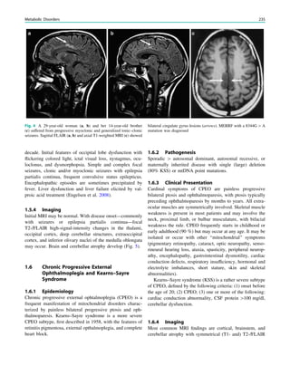 decade. Initial features of occipital lobe dysfunction with
ﬂickering colored light, ictal visual loss, nystagmus, ocu-
loclonus, and dysmorphopsia. Simple and complex focal
seizures, clonic and/or myoclonic seizures with epilepsia
partialis continua, frequent convulsive status epilepticus.
Encephalopathic episodes are sometimes precipitated by
fever. Liver dysfunction and liver failure elicited by val-
proic acid treatment (Engelsen et al. 2008).
1.5.4 Imaging
Initial MRI may be normal. With disease onset—commonly
with seizures or epilepsia partialis continua—focal
T2-/FLAIR high-signal-intensity changes in the thalami,
occipital cortex, deep cerebellar structures, extraoccipital
cortex, and inferior olivary nuclei of the medulla oblongata
may occur. Brain and cerebellar atrophy develop (Fig. 5).
1.6 Chronic Progressive External
Ophthalmoplegia and Kearns–Sayre
Syndrome
1.6.1 Epidemiology
Chronic progressive external ophtalmoplegia (CPEO) is a
frequent manifestation of mitochondrial disorders charac-
terized by painless bilateral progressive ptosis and oph-
thalmoparesis. Kearns–Sayre syndrome is a more severe
CPEO subtype, ﬁrst described in 1958, with the features of
retinitis pigmentosa, external opthalmoplegia, and complete
heart block.
1.6.2 Pathogenesis
Sporadic [ autosomal dominant, autosomal recessive, or
maternally inherited disease with single (large) deletion
(80% KSS) or mtDNA point mutations.
1.6.3 Clinical Presentation
Cardinal symptoms of CPEO are painless progressive
bilateral ptosis and ophthalmoparesis, with ptosis typically
preceding ophthalmoparesis by months to years. All extra-
ocular muscles are symmetrically involved. Skeletal muscle
weakness is present in most patients and may involve the
neck, proximal limb, or bulbar musculature, with bifacial
weakness the rule. CPEO frequently starts in childhood or
early adulthood (90 %) but may occur at any age. It may be
isolated or occur with other ‘‘mitochondrial’’ symptoms
(pigmentary retinopathy, cataract, optic neuropathy, senso-
rineural hearing loss, ataxia, spasticity, peripheral neurop-
athy, encephalopathy, gastrointestinal dysmotility, cardiac
conduction defects, respiratory insufﬁciency, hormonal and
electrolyte imbalances, short stature, skin and skeletal
abnormalities).
Kearns–Sayre syndrome (KSS) is a rather severe subtype
of CPEO, deﬁned by the following criteria: (1) onset before
the age of 20; (2) CPEO; (3) one or more of the following:
cardiac conduction abnormality, CSF protein [100 mg/dl,
cerebellar dysfunction.
1.6.4 Imaging
Most common MRI ﬁndings are cortical, brainstem, and
cerebellar atrophy with symmetrical (T1- and) T2-/FLAIR
Fig. 4 A 29-year-old woman (a, b) and her 14-year-old brother
(c) suffered from progressive myoclonic and generalized tonic–clonic
seizures. Sagittal FLAIR (a, b) and axial T1-weighted MRI (c) showed
bilateral cingulate gyrus lesions (arrows). MERRF with a 8344G[A
mutation was diagnosed
Metabolic Disorders 235
 