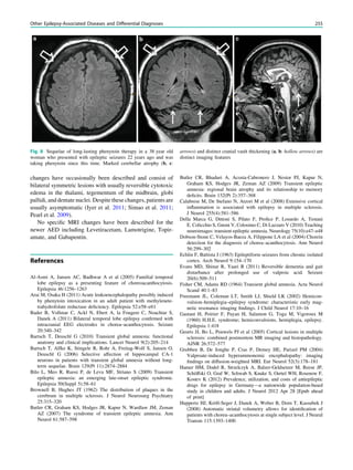 changes have occasionally been described and consist of
bilateral symmetric lesions with usually reversible cytotoxic
edema in the thalami, tegementum of the midbrain, globi
pallidi, and dentate nuclei. Despite these changes, patients are
usually asymptomatic (Iyer et al. 2011; Simao et al. 2011;
Pearl et al. 2009).
No speciﬁc MRI changes have been described for the
newer AED including Levetiracetam, Lamotrigine, Topir-
amate, and Gabapentin.
References
Al-Asmi A, Jansen AC, Badhwar A et al (2005) Familial temporal
lobe epilepsy as a presenting feature of choreoacanthocytosis.
Epilepsia 46:1256–1263
Arai M, Osaka H (2011) Acute leukoencephalopathy possibly induced
by phenytoin intoxication in an adult patient with methylenete-
trahydrofolate reductase deﬁciency. Epilepsia 52:e58–e61
Bader B, Vollmar C, Ackl N, Ebert A, la Fougere C, Noachtar S,
Danek A (2011) Bilateral temporal lobe epilepsy conﬁrmed with
intracranial EEG electrodes in chorea–acanthocytosis. Seizure
20:340–342
Bartsch T, Deuschl G (2010) Transient global amnesia: functional
anatomy and clinical implications. Lancet Neurol 9(2):205–214
Bartsch T, Alfke K, Stingele R, Rohr A, Freitag-Wolf S, Jansen O,
Deuschl G (2006) Selective affection of hippocampal CA-1
neurons in patients with transient global amnesia without long-
term sequelae. Brain 129(Pt 11):2874–2884
Bilo L, Meo R, Ruosi P, de Leva MF, Striano S (2009) Transient
epileptic amnesia: an emerging late-onset epileptic syndrome.
Epilepsia 50(Suppl 5):58–61
Brownell B, Hughes JT (1962) The distribution of plaques in the
cerebrum in multiple sclerosis. J Neurol Neurosurg Psychiatry
25:315–320
Butler CR, Graham KS, Hodges JR, Kapur N, Wardlaw JM, Zeman
AZ (2007) The syndrome of transient epileptic amnesia. Ann
Neurol 61:587–598
Butler CR, Bhaduri A, Acosta-Cabronero J, Nestor PJ, Kapur N,
Graham KS, Hodges JR, Zeman AZ (2009) Transient epileptic
amnesia: regional brain atrophy and its relationship to memory
deﬁcits. Brain 132(Pt 2):357–368
Calabrese M, De Stefano N, Atzori M et al (2008) Extensive cortical
inﬂammation is associated with epilepsy in multiple sclerosis.
J Neurol 255(4):581–586
Della Marca G, Dittoni S, Pilato F, Proﬁce P, Losurdo A, Testani
E. Colicchio S, Gnoni V, Colosimo C, Di Lazzaro V (2010) Teaching
neuroimages: transient epileptic amnesia. Neurology 75(10):e47–e48
Dobson-Stone C, Velayos-Baeza A, Filippone LA et al (2004) Chorein
detection for the diagnosis of chorea–acanthocytosis. Ann Neurol
56:299–302
Echlin F, Battista J (1963) Epileptiform seizures from chronic isolated
cortex. Arch Neurol 9:154–170
Evans MD, Shinar R, Yaari R (2011) Reversible dementia and gait
disturbance after prolonged use of valproic acid. Seizure
20(6):509–511
Fisher CM, Adams RD (1964) Transient global amnesia. Acta Neurol
Scand 40:1–83
Freemann JL, Coleman LT, Smith LJ, Shield LK (2002) Hemicon-
vulsion–hemiplegia–epilepsy syndrome: characteristic early mag-
netic resonance imaging ﬁndings. J Child Neurol 17:10–16
Gastaut H, Poirier F, Payan H, Salamon G, Toga M, Vigoroux M
(1960) H.H.E. syndrome; hemiconvulsions, hemiplegia, epilepsy.
Epilepsia 1:418
Geurts JJ, Bo L, Pouwels PJ et al (2005) Cortical lesions in multiple
sclerosis: combined postmortem MR imaging and histopathology.
AJNR 26:572–577
Grubben B, De Jonghe P, Cras P, Demey HE, Parizel PM (2004)
Valproate-induced hyperammonemic encephalopathy: imaging
ﬁndings on diffusion-weighted MRI. Eur Neurol 52(3):178–181
Hamer HM, Dodel R, Strzelczyk A, Balzer-Geldsetzer M, Reese JP,
Schöffski O, Graf W, Schwab S, Knake S, Oertel WH, Rosenow F,
Kostev K (2012) Prevalence, utilization, and costs of antiepileptic
drugs for epilepsy in Germany—a nationwide population-based
study in children and adults. J Neurol 2012 Apr 28 [Epub ahead
of print]
Huppertz HJ, Kröll-Seger J, Danek A, Weber B, Dorn T, Kassubek J
(2008) Automatic striatal volumetry allows for identiﬁcation of
patients with chorea–acanthocytosis at single subject level. J Neural
Transm 115:1393–1400
Fig. 8 Sequelae of long-lasting phenytoin therapy in a 38 year old
woman who presented with epileptic seizures 22 years ago and was
taking phenytoin since this time. Marked cerebellar atrophy (b, c:
arrows) and distinct cranial vault thickening (a, b: hollow arrows) are
distinct imaging features
Other Epilepsy-Associated Diseases and Differential Diagnoses 255
 