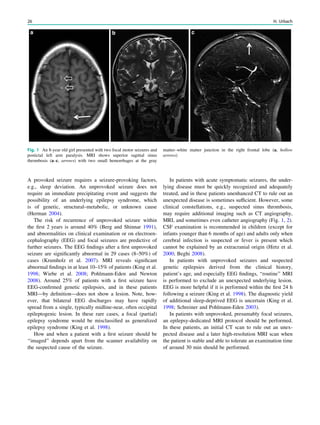 A provoked seizure requires a seizure-provoking factors,
e.g., sleep deviation. An unprovoked seizure does not
require an immediate precipitating event and suggests the
possibility of an underlying epilepsy syndrome, which
is of genetic, structural–metabolic, or unknown cause
(Herman 2004).
The risk of recurrence of unprovoked seizure within
the ﬁrst 2 years is around 40% (Berg and Shinnar 1991),
and abnormalities on clinical examination or on electroen-
cephalography (EEG) and focal seizures are predictive of
further seizures. The EEG ﬁndings after a ﬁrst unprovoked
seizure are signiﬁcantly abnormal in 29 cases (8–50%) of
cases (Krumholz et al. 2007). MRI reveals signiﬁcant
abnormal ﬁndings in at least 10–15% of patients (King et al.
1998; Wiebe et al. 2008; Pohlmann-Eden and Newton
2008). Around 25% of patients with a ﬁrst seizure have
EEG-conﬁrmed genetic epilepsies, and in these patients
MRI—by deﬁnition—does not show a lesion. Note, how-
ever, that bilateral EEG discharges may have rapidly
spread from a single, typically midline-near, often occipital
epileptogenic lesion. In these rare cases, a focal (partial)
epilepsy syndrome would be misclassiﬁed as generalized
epilepsy syndrome (King et al. 1998).
How and when a patient with a ﬁrst seizure should be
‘‘imaged’’ depends apart from the scanner availability on
the suspected cause of the seizure.
In patients with acute symptomatic seizures, the under-
lying disease must be quickly recognized and adequately
treated, and in these patients unenhanced CT to rule out an
unexpected disease is sometimes sufﬁcient. However, some
clinical constellations, e.g., suspected sinus thrombosis,
may require additional imaging such as CT angiography,
MRI, and sometimes even catheter angiography (Fig. 1, 2).
CSF examination is recommended in children (except for
infants younger than 6 months of age) and adults only when
cerebral infection is suspected or fever is present which
cannot be explained by an extracranial origin (Hirtz et al.
2000; Beghi 2008).
In patients with unprovoked seizures and suspected
genetic epilepsies derived from the clinical history,
patient’s age, and especially EEG ﬁndings, ‘‘routine’’ MRI
is performed to exclude an unexpected underlying lesion.
EEG is more helpful if it is performed within the ﬁrst 24 h
following a seizure (King et al. 1998). The diagnostic yield
of additional sleep-deprived EEG is uncertain (King et al.
1998; Schreiner and Pohlmann-Eden 2003).
In patients with unprovoked, presumably focal seizures,
an epilepsy-dedicated MRI protocol should be performed.
In these patients, an initial CT scan to rule out an unex-
pected disease and a later high-resolution MRI scan when
the patient is stable and able to tolerate an examination time
of around 30 min should be performed.
Fig. 1 An 8-year old girl presented with two focal motor seizures and
postictal left arm paralysis. MRI shows superior sagittal sinus
thrombosis (a–c, arrows) with two small hemorrhages at the gray
matter–white matter junction in the right frontal lobe (a, hollow
arrows)
26 H. Urbach
 
