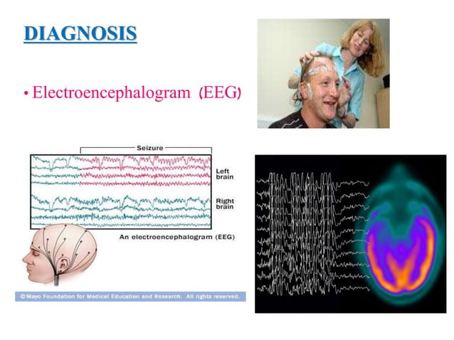 Epilepsy | PPTX | Brain and Nervous System Disorders | Diseases and ...