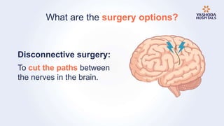 Disconnective Epilepsy or Seizures: Symptoms, Causes, Prevention and Treatment | PPTX