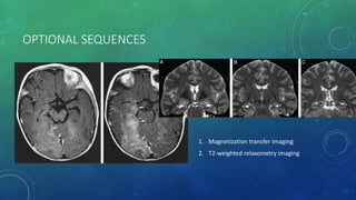 OPTIONAL SEQUENCES
1. Magnetization transfer imaging
2. T2-weighted relaxometry imaging
 