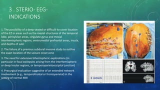 3 . STERIO- EEG-
INDICATIONS
1. The possibility of a deep-seated or difficult-to-cover location
of the EZ in areas such as the mesial structures of the temporal
lobe, perisylvian areas, cingulate gyrus and mesial
interhemispheric regions, ventromedial prefrontal areas, insula,
and depths of sulci
2. The failure of a previous subdural invasive study to outline
the exact location of the seizure onset zone
3. The need for extensive bihemispheric explorations (in
particular in focal epilepsies arising from the interhemispheric
or deep insular regions, or temporoparietooccipital junction)
4. Presurgical evaluation suggestive of an extended network
involvement (e.g., temporofrontal or frontoparietal) in the
setting of normal MRI
 