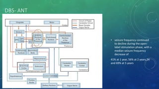 DBS- ANT
• seizure frequency continued
to decline during the open-
label stimulation phase, with a
median seizure frequency
decrease of
41% at 1 year, 56% at 2 years,24
and 69% at 5 years
 