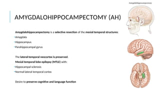 Epilepsy Surgery Neurosurgery Teory.pptx