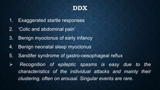 Sandifer Reflex Epileptic encephalopathies during infancy | PPTX