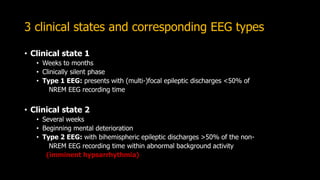 3 clinical states and corresponding EEG types
• Clinical state 1
• Weeks to months
• Clinically silent phase
• Type 1 EEG: presents with (multi-)focal epileptic discharges <50% of
NREM EEG recording time
• Clinical state 2
• Several weeks
• Beginning mental deterioration
• Type 2 EEG: with bihemispheric epileptic discharges >50% of the non-
NREM EEG recording time within abnormal background activity
(imminent hypsarrhythmia)
 