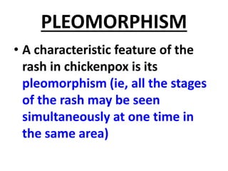 EPIDEMIOLOGY OF CHICKEN POX | PPTX