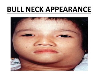 BULL NECK APPEARANCE
 