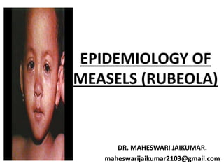 EPIDEMIOLOGY OF
MEASELS (RUBEOLA)
DR. MAHESWARI JAIKUMAR.
maheswarijaikumar2103@gmail.com
 