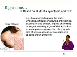 Right time… Based on student’s symptoms and ECP  e.g., hives spreading over the body, wheezing, difficulty swallowing or breathing, swelling in face or neck, tingling or swelling of tongue, vomiting, signs of shock, such as extreme paleness/gray color, clammy skin, loss of consciousness, or any other child-specific known symptom.  