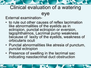 Clinical evaluation of a watering
eye
External examination-
• to rule out other causes of reflex lacrimation
like abnormalities of the eyelids as in
ectropion, punctal ectropion or eversion,
lagophthalmos, Lacrimal pump weakness
because of laxity of the eyelids, weakness of
orbicularis oculi
• Punctal abnormalities like atresia of punctum,
punctal ectropion
• Presence of swelling in the lacrimal sac
indicating nasolacrimal duct obstruction
 