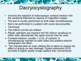 Dacryocystography
• Involves the injection of radio-opaque contrast medium into
the canaliculi followed by capture of magnified images.
• The test is usually performed on both sides simultaneously.
• Not to be performed in a patient with acute dacryocystitis.
• Technique
 The inferior puncta are dilated.
 Plastic catheters are inserted into the inferior canaliculi on
either side; alternatively the upper puncta may be used.
 Contrast medium, usually 1–2 mL of Lipiodol, is
simultaneously injected on both sides and postero-anterior
radiographs are taken.
 Ten minutes later an erect oblique film is taken to assess the
effect of gravity on tear drainage. Digital subtraction DCG
provides a higher quality image capture than conventional
 