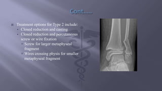  Treatment options for Type 2 include:
• Closed reduction and casting
• Closed reduction and percutaneous
screw or wire fixation
 Screw for larger metaphyseal
fragment
 Wires crossing physis for smaller
metaphyseal fragment
 