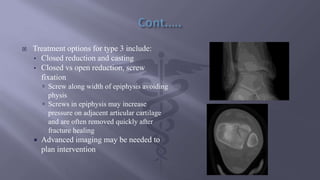  Treatment options for type 3 include:
• Closed reduction and casting
• Closed vs open reduction, screw
fixation
 Screw along width of epiphysis avoiding
physis
 Screws in epiphysis may increase
pressure on adjacent articular cartilage
and are often removed quickly after
fracture healing
 Advanced imaging may be needed to
plan intervention
 