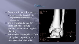  Treatment for type 4 is surgery
 Anatomic reduction of physis
required to minimize risk of
physeal bar
 CT is crucial and gives 3D
visualization of fracture
patterns; Essential for surgical
planning
 Fixation best accomplished from
epiphysis to epiphysis and/or
metaphysis to metaphysis
 