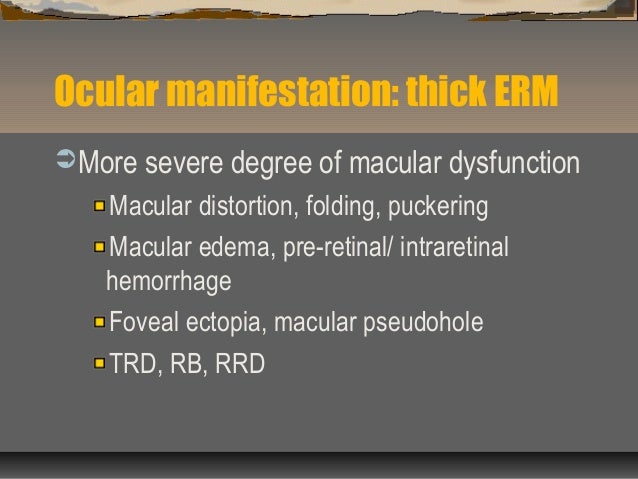 NW2010 Epiretinal Membrane NW2010 Epiretinal Membrane