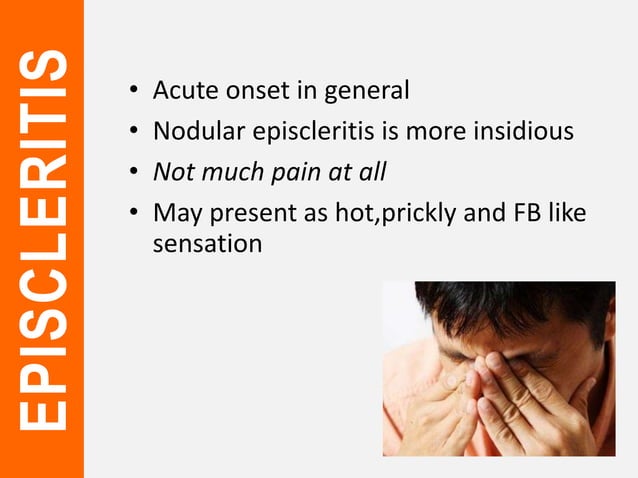 Episcelaritis Episcleritis and scleritis | PPTX | Eye and Vision Conditions ...